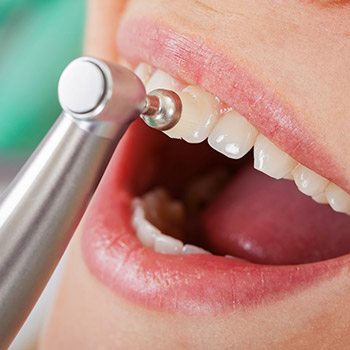 woman getting teeth polish