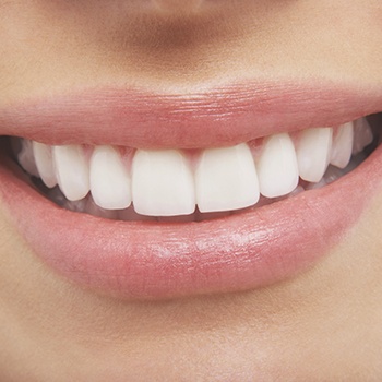 Closeup of healthy smile