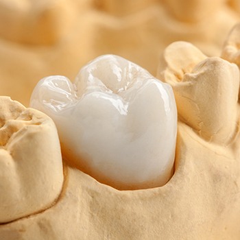 Model tooth with dental crown