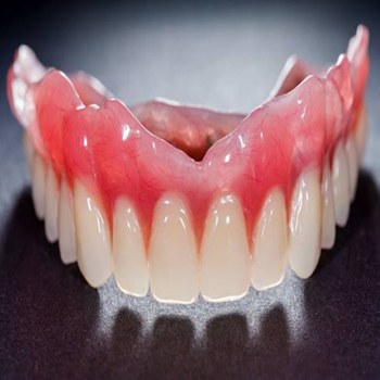 A full arch denture