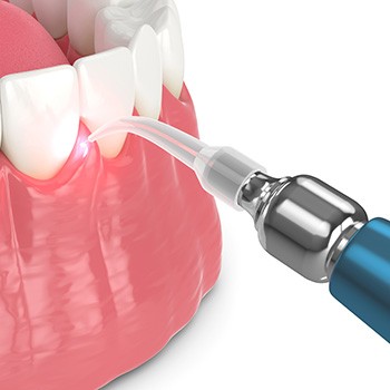 Closeup of a man smiling