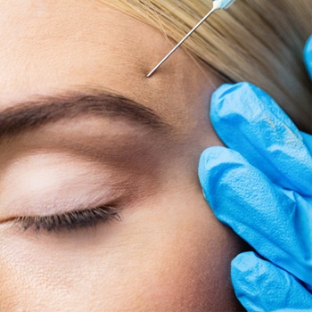 woman receiving Botox