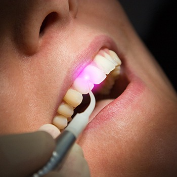 Closeup of patient experiencing laser treatment