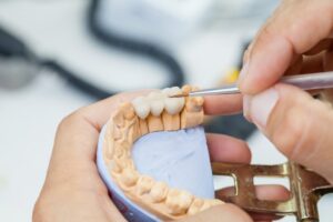 Dentist holding impression of teeth with crowns.