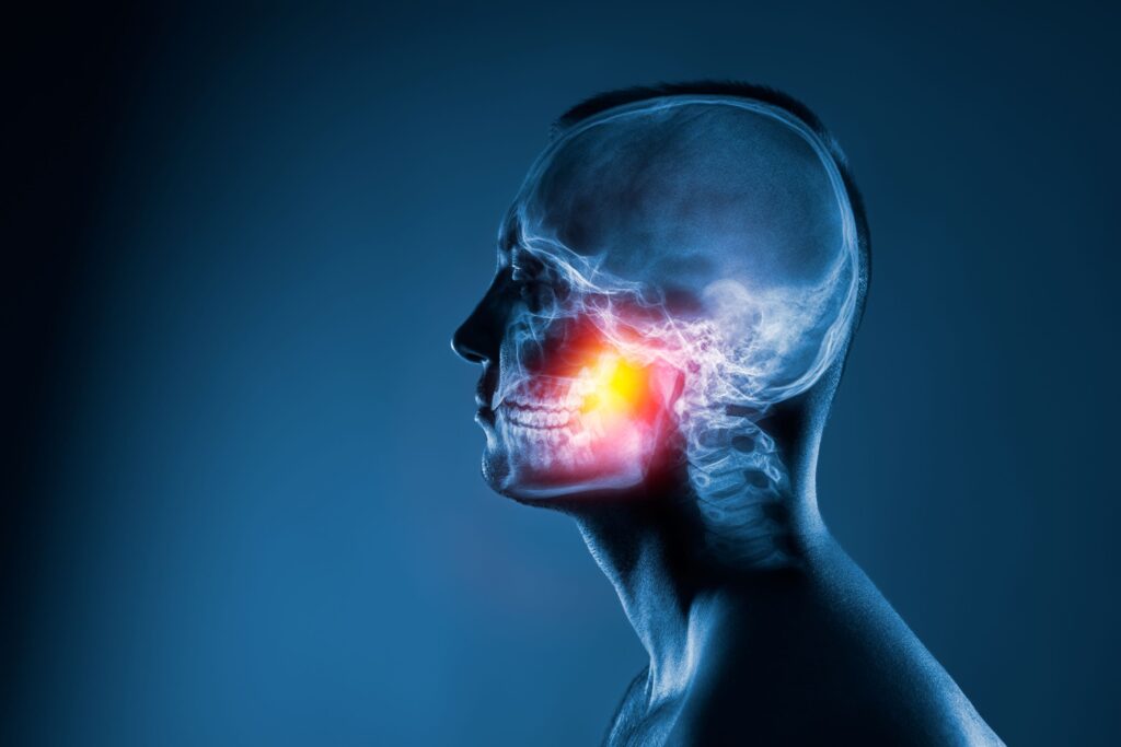 Profile view of skeleton with jaw inflamed and orange